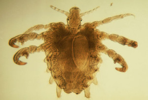 getty_rm_photo_of_pubic_lice1