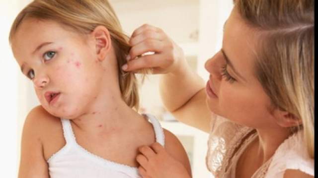cele mai comune probleme de piele la copii