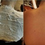 Izgorjela je na suncu, a ovaj 1 trik njene majke ju je spasio:Riječ je o proizvodu koji svi imamo…