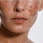 SODA BIKARBONA uklanja staračke mrlje: Ovo morate napraviti SODA BIKARBONA uklanja staračke mrlje: Ovo morate napraviti - featured image