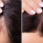 Zovu je “ŽIVA VODA”: Zaboravite skupe tretmane, ovo će zaustaviti opadanje kose i popraviti kosu – rezultati za 3 dana! Zovu je “ŽIVA VODA”: Zaboravite skupe tretmane, ovo će zaustaviti opadanje kose i popraviti kosu – rezultati za 3 dana! - featured image