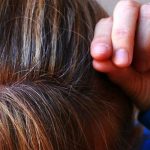 BUBULJICE NA GLAVI SU SVE ČEŠĆI PROBLEM: Ni slučajno ih ne istiskujte, evo zašto se javljaju I ŠTA TREBATE URADITI DA NESTANU BUBULJICE NA GLAVI SU SVE ČEŠĆI PROBLEM: Ni slučajno ih ne istiskujte, evo zašto se javljaju I ŠTA TREBATE URADITI DA NESTANU - featured image