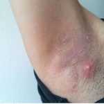 LJUDI SE NE PERU ISPOD PAZUHA KAKO TREBA: Stručnjak za higijenu savetuje čime da izlečite bubuljice i uklonite znoj LJUDI SE NE PERU ISPOD PAZUHA KAKO TREBA: Stručnjak za higijenu savetuje čime da izlečite bubuljice i uklonite znoj - featured image