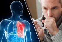 Nikad više nećete dobiti bronhitis i kašalj: Prirodni lek za decu i odrasle Nikad više nećete dobiti bronhitis i kašalj: Prirodni lek za decu i odrasle - featured image