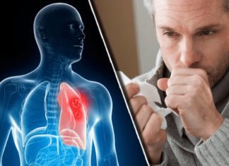 Nikad više nećete dobiti bronhitis i kašalj: Prirodni lek za decu i odrasle Nikad više nećete dobiti bronhitis i kašalj: Prirodni lek za decu i odrasle - featured image