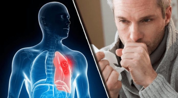 Nikad više nećete dobiti bronhitis i kašalj: Prirodni lek za decu i odrasle Nikad više nećete dobiti bronhitis i kašalj: Prirodni lek za decu i odrasle - featured image